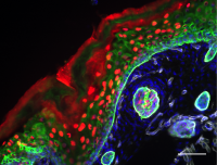 H2B-RFP Hyperproliferative Skin - Ezratty Lab